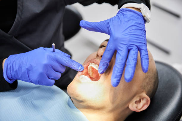 Best Emergency Dentist for Lost Fillings or Crowns in West Lafayette, OH
